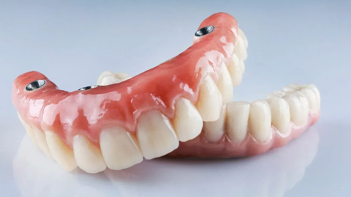 Fixed hybrid denture secured on dental implants at Rancho Bernardo Dental Arts in San Diego