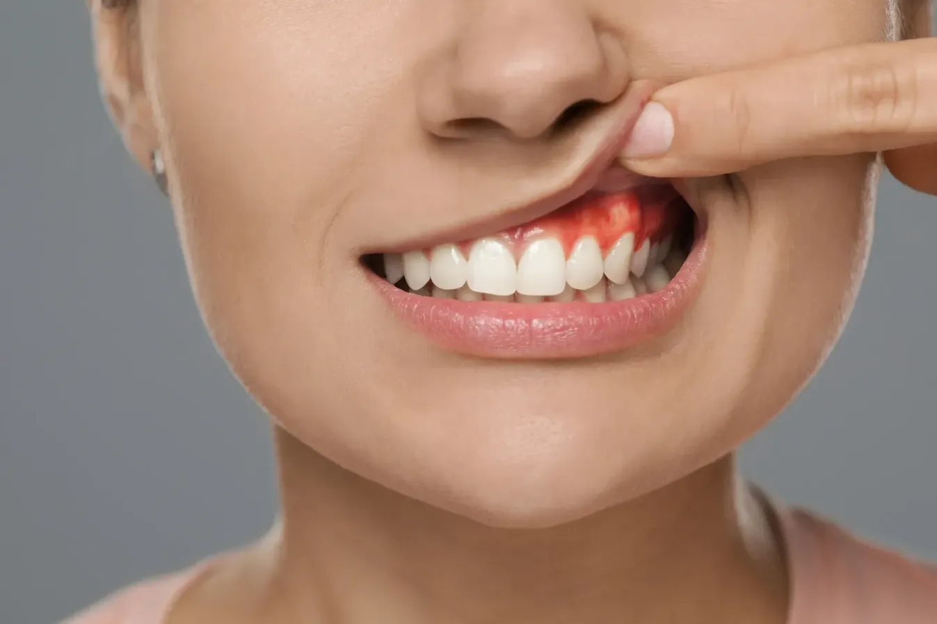 Comprehensive gum disease treatment at Rancho Bernardo Dental Arts in San Diego